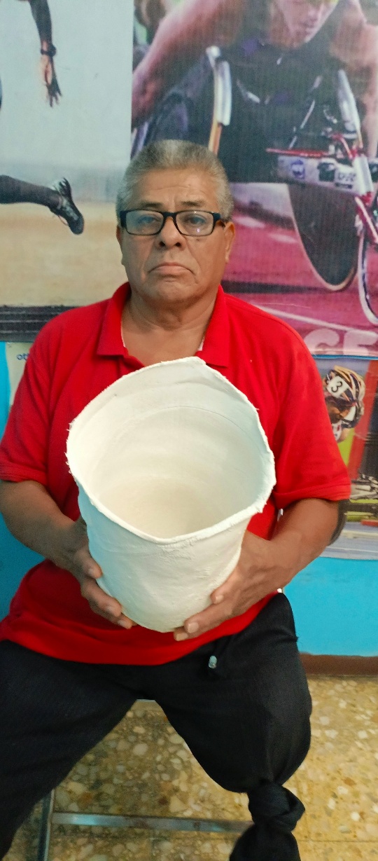 Margarito holding his prosthetic socket at the fitting clinic in Mexico