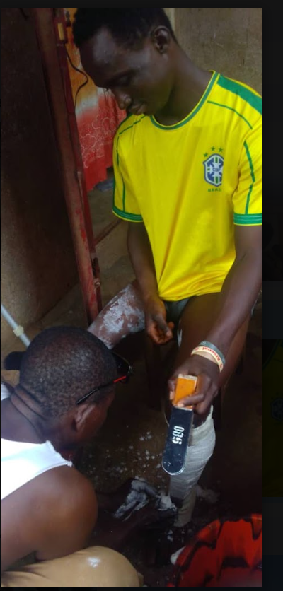 Prosthetic fitting session in Sierra Leone