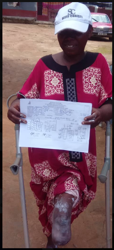 Prosthetic fitting session in Sierra Leone