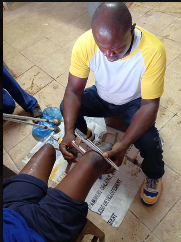 Prosthetic fitting session in Sierra Leone